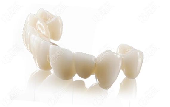 深度解析漳州漳口雅康口腔牙齿种植技术:涵盖核心特点、关键作用、显著优势、潜在不足及科学护理指南