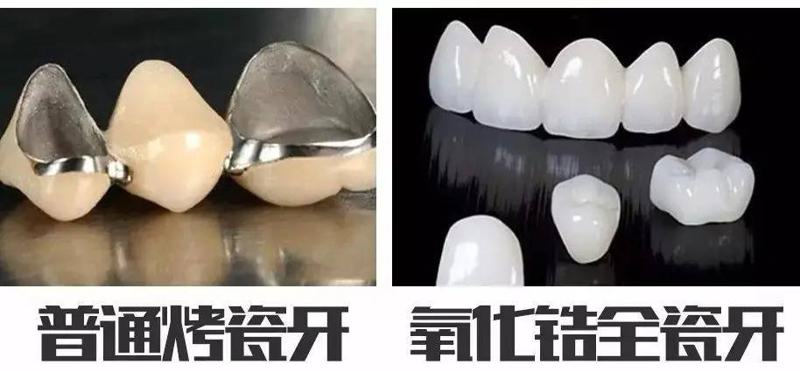 江西慈尔口腔怎么样？从评价看医生技术好种植牙矫正收费合理