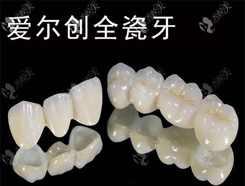 德国VITA全瓷牙好在哪？专业解析真实效果与合理收费，泉州贝成口腔连锁医生推荐！