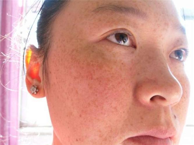 济南海峡美容整形医院信息分享，内附整形问答＋案例分析