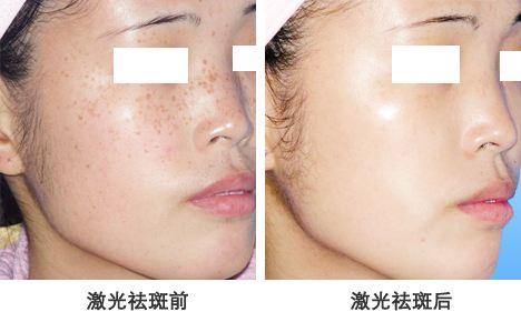 唐山菩瑞提医疗美容激光美容科怎么样?附上激光美容案例分享+医院新挂号时间