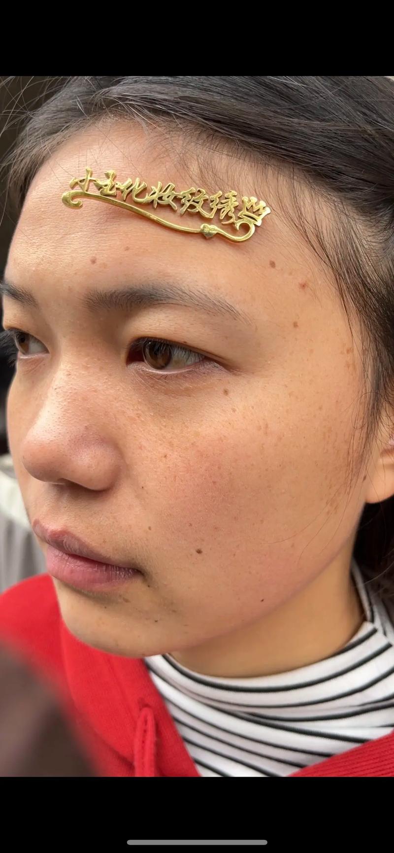 昆明杰西艾整形外科医院祛斑技术怎么样？医院口碑及案例分享