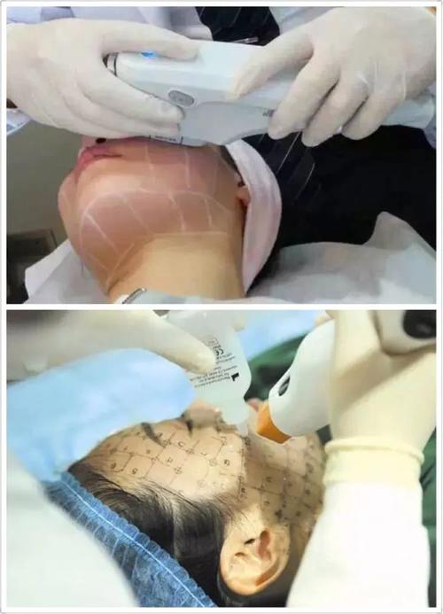 长沙天心王清波口腔眼部热玛吉价格表公布(4394元起丨专业医生操作丨效果持久)