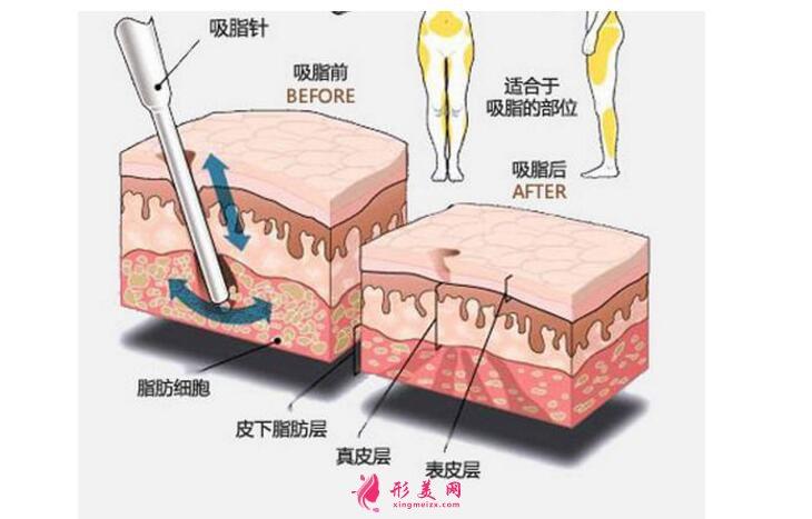 沈阳名流医疗美容医院吸