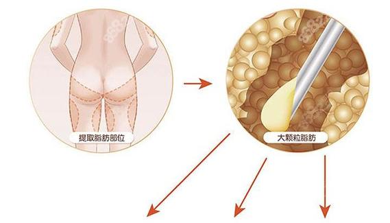 广州艺星医疗美容医院(华南旗舰院)整形美容怎么样,实力医生推荐+问答