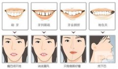绍兴皓博士口腔矫正牙齿