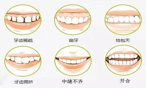 求问漱口水可以代替刷牙
