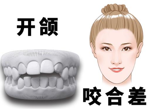 根管治疗要去几次多久才