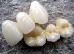 乐山贝斯特口腔矫正牙齿