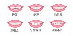 沈阳牙齿种植价格表20