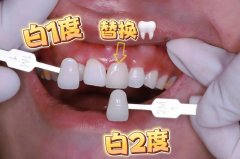 荆州咿呀口腔2026年牙齿