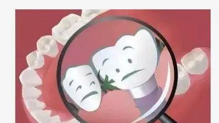 医生说矫正牙齿有脱落的风险，还能整牙吗？牙根短整牙有风险