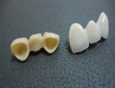 沧州河间市人民医院牙齿