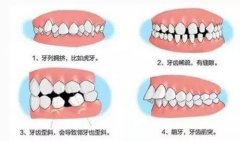 武汉固瑞齿科牙齿矫正价