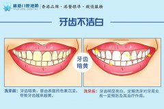 开封优尚口腔医院收费明