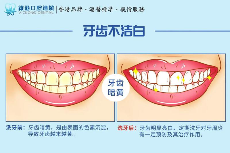 北京齿康达口腔丨职业儿