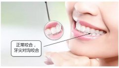 盘锦牙齿矫正多少钱？市