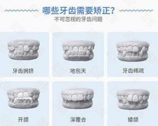 淄博张店夏日口腔详解牙
