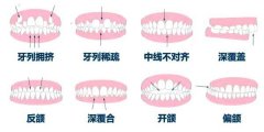 了解清楚！成都梅吉口腔