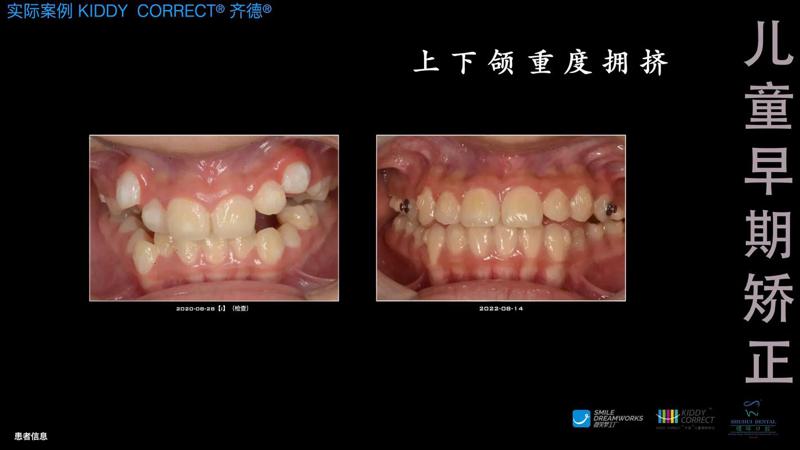 贵阳朗朗口腔评价真实口碑分享，技术不错-服务周到-收费实惠