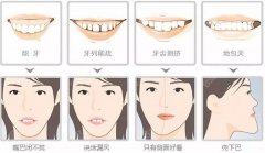 哈尔滨卿本佳人牙齿矫正