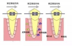 合肥佳德口腔种植牙价格