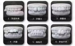 曝光2026年广州麦特登口