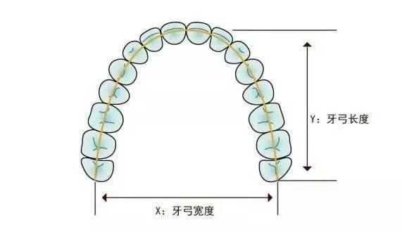 湘西口腔医院牙齿矫正怎