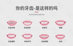 北京科尔口腔牙齿矫正价