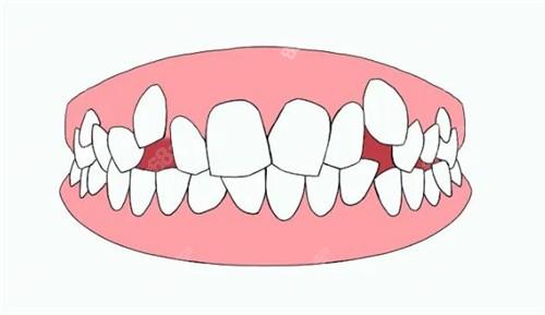 福能海峡口腔不坑人，中高端档次牙科定价合理、种牙口碑好
