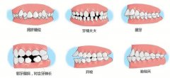 石家庄双合口腔牙齿矫正