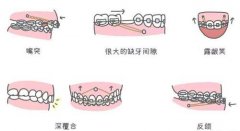 查看南京卡瓦口腔牙齿矫