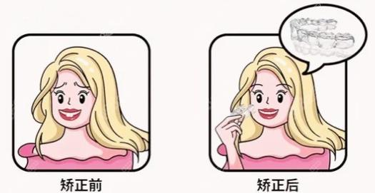 轻松拥有自信笑容，杭州东辰口腔门诊部牙齿矫正现仅需6000元起，原价8000元起，优惠力度大！