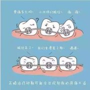 天津皓雅口腔牙齿矫正价
