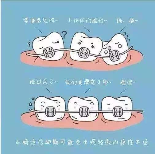 宁海牙贝恩口腔牙齿矫正价格表公开透明，金属6800-隐形26800元起