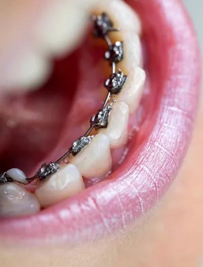 重庆大足贝嘉口腔诊所推