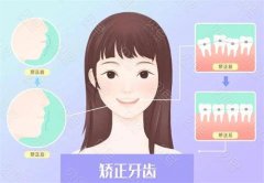 金华王萍口腔医院牙齿矫