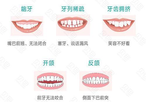 重庆永川德贝口腔价格表