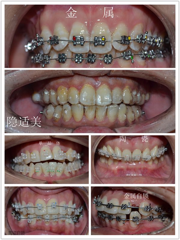 九江诺一齿科怎么样？从