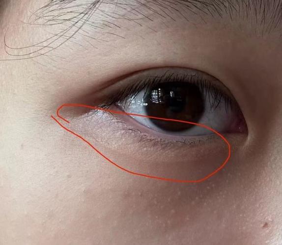树脂补牙材料对人体有害