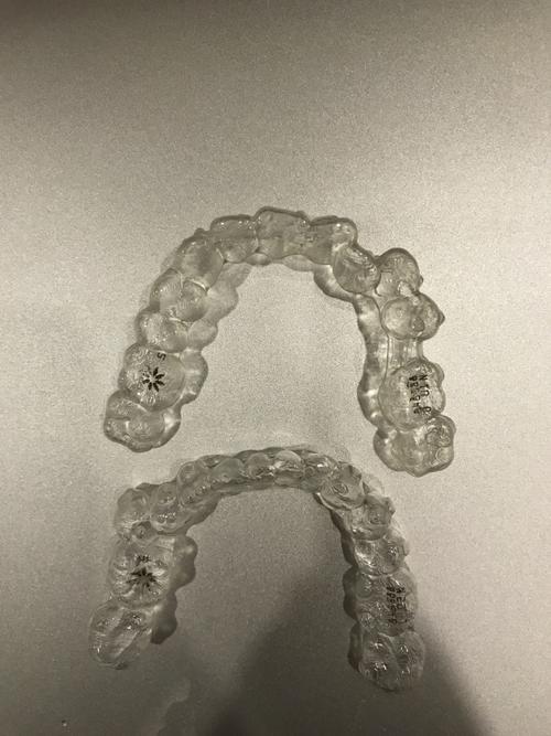 泉州贝成口腔连锁牙齿矫正究竟需要多久？矫正时间影响因素全解析