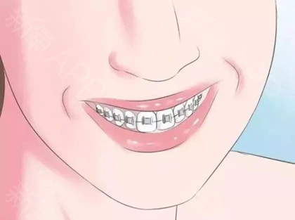 宜昌咿呀口腔牙齿矫正技术怎么样？隐形矫正有什么特别优势？