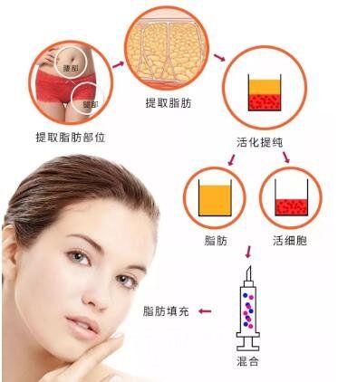 广州华美医疗美容医院怎么样?医生技术精湛案例分享