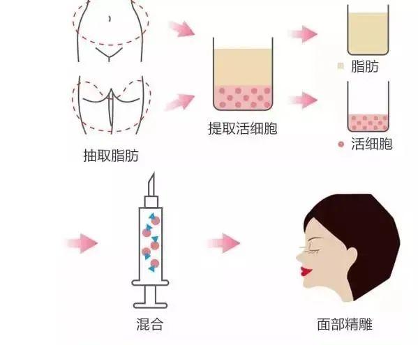 北京泛美医疗美容医院技术好不好?医院详细介绍说明