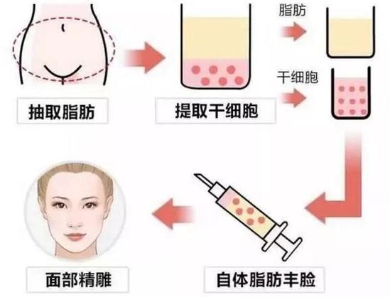 徐州医科大学附属医院整形美容科自体脂肪填充靠谱吗?医院简介+医生介绍