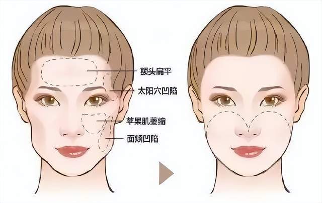 新疆医科大学第一附属医院整形科,医院服务质量测评!