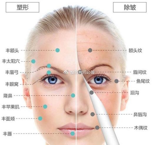 武汉壹加壹医疗美容医院整形手术怎么样？隆鼻手术真人高效，以及术后相关问答