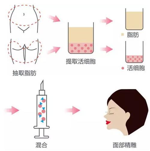 武汉艺星医疗美容医院杨国梁和张琦谁更擅长眼部整形，医生资料&技术特色