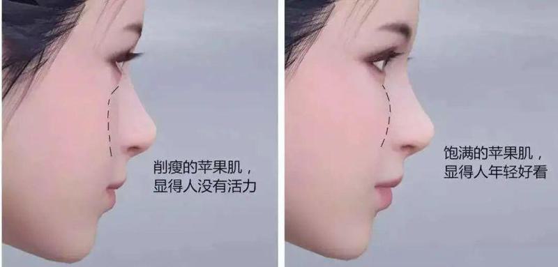 广州可玉医疗美容医院技术怎么样?一键了解相关信息丨案例反馈曝光