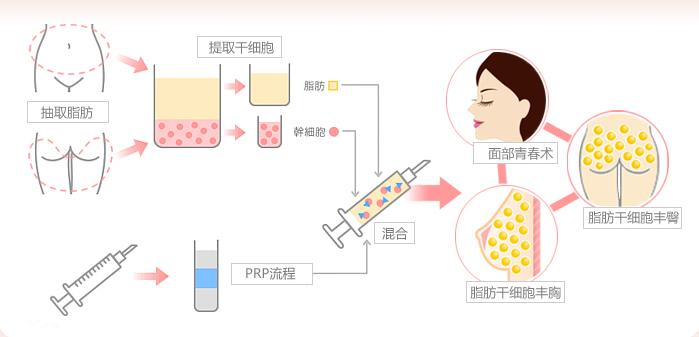 合肥智善美医疗美容怎么样？术后过程&科普问答